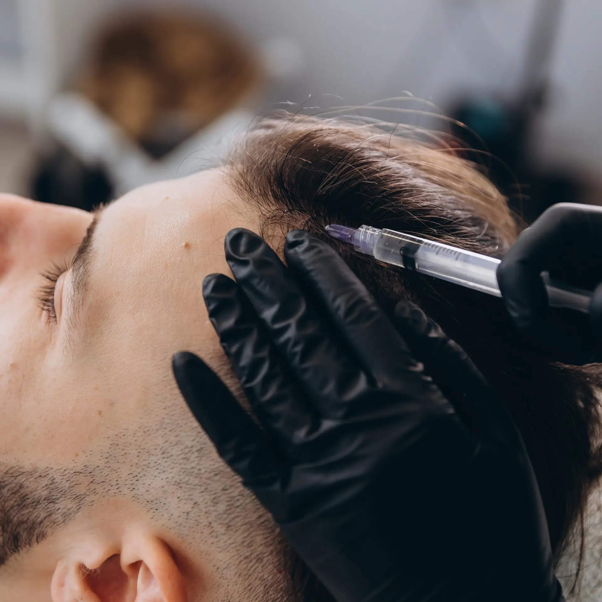 Patient receiving scalp injection treatment for hair restoration